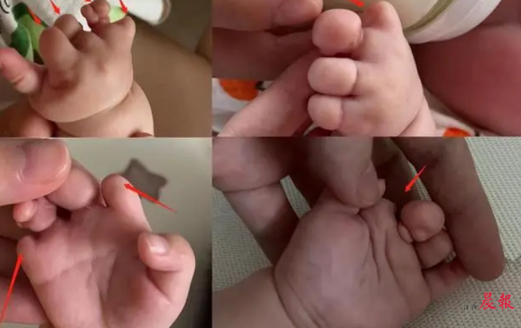 经期血块较多怎么回事 经期血块特别多怎么回事